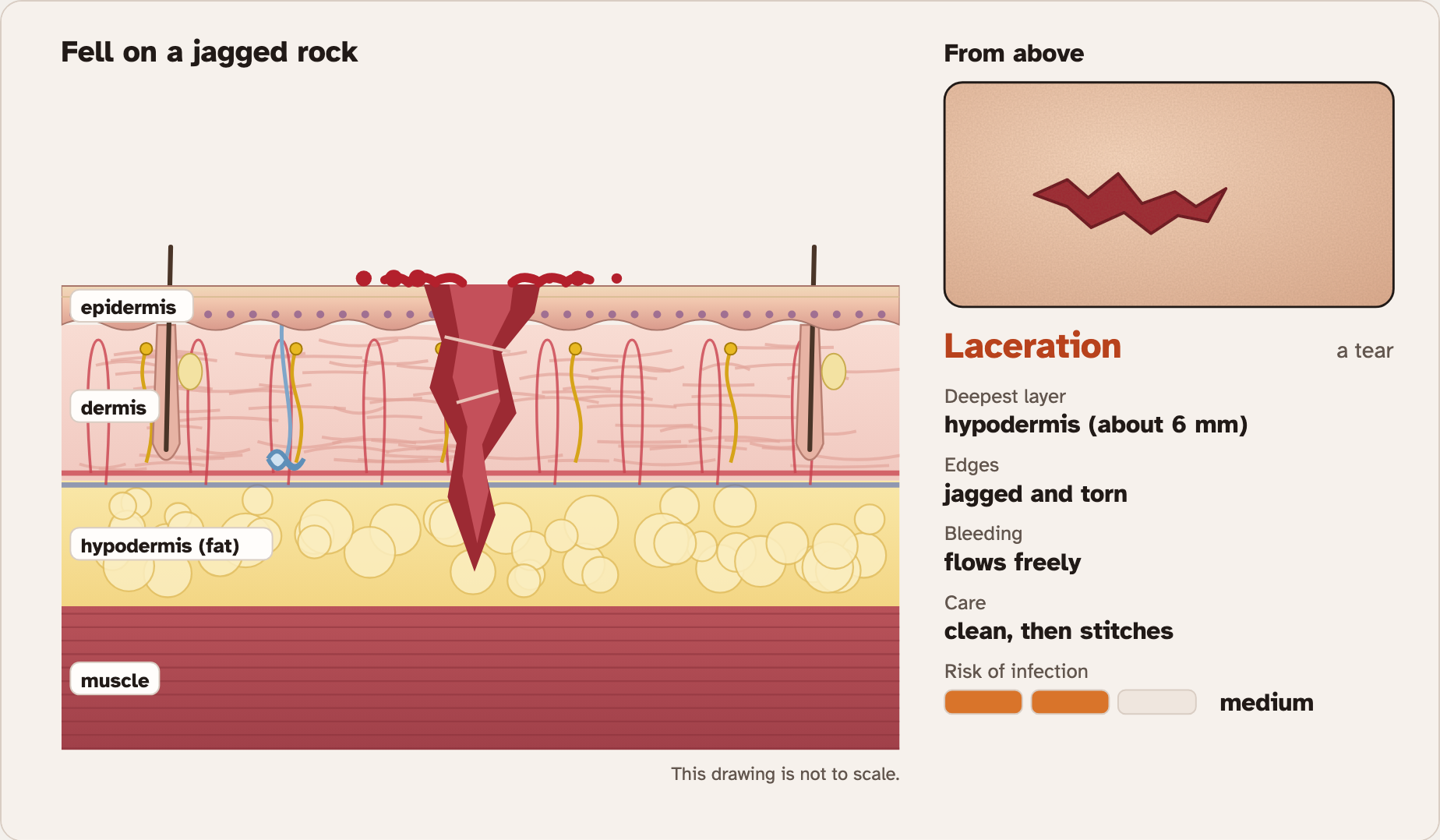 Burns and Wounds Lab: slideshow