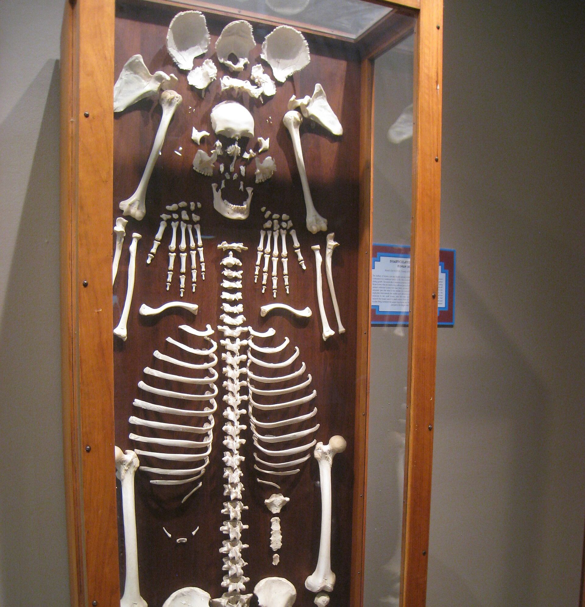 A museum case holding every bone of a human skeleton, taken apart and laid out flat in the shape of a body