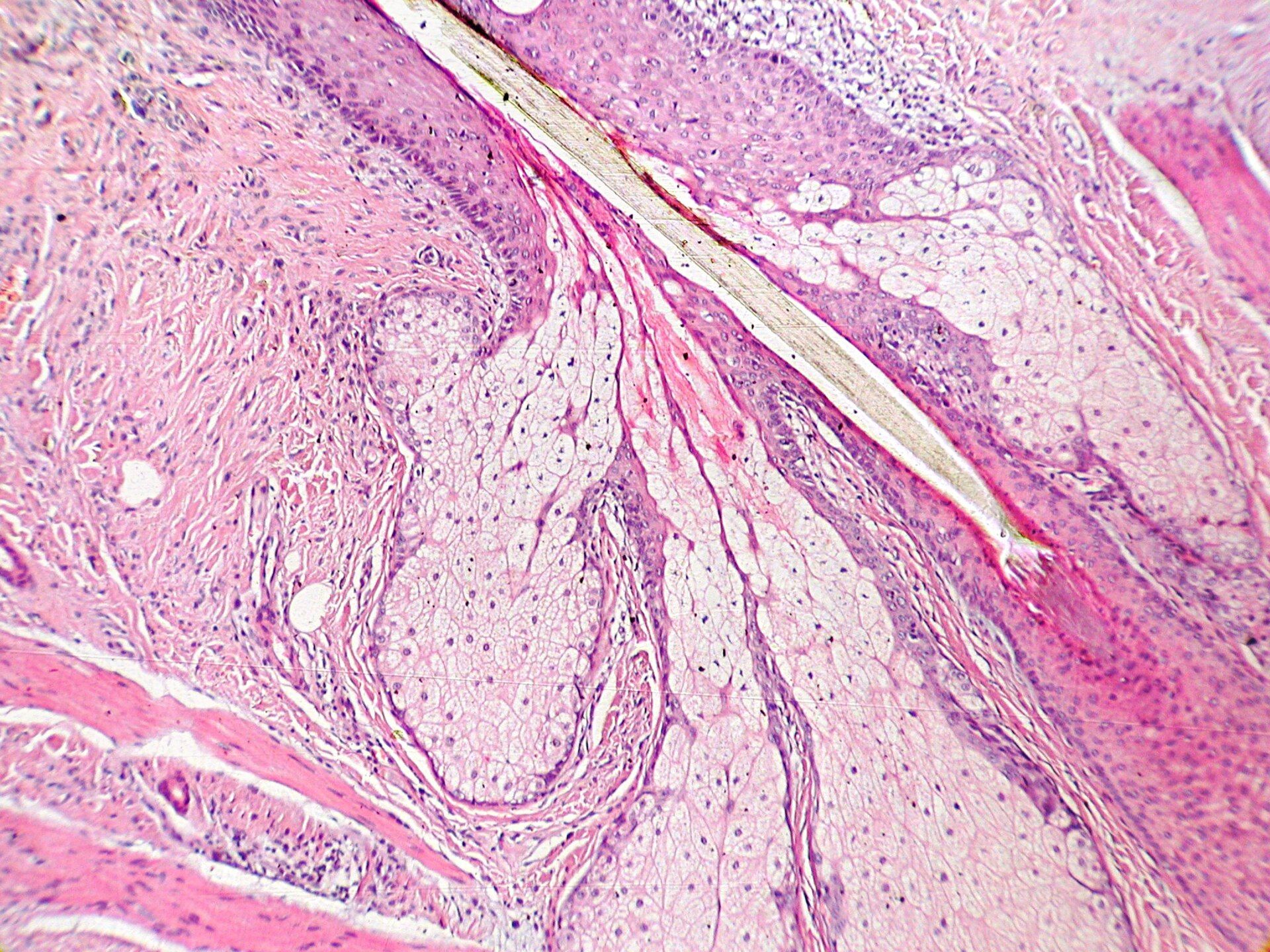 A thin slice of real skin under a microscope, stained pink and purple, with a hair in its follicle and pale glands beside it