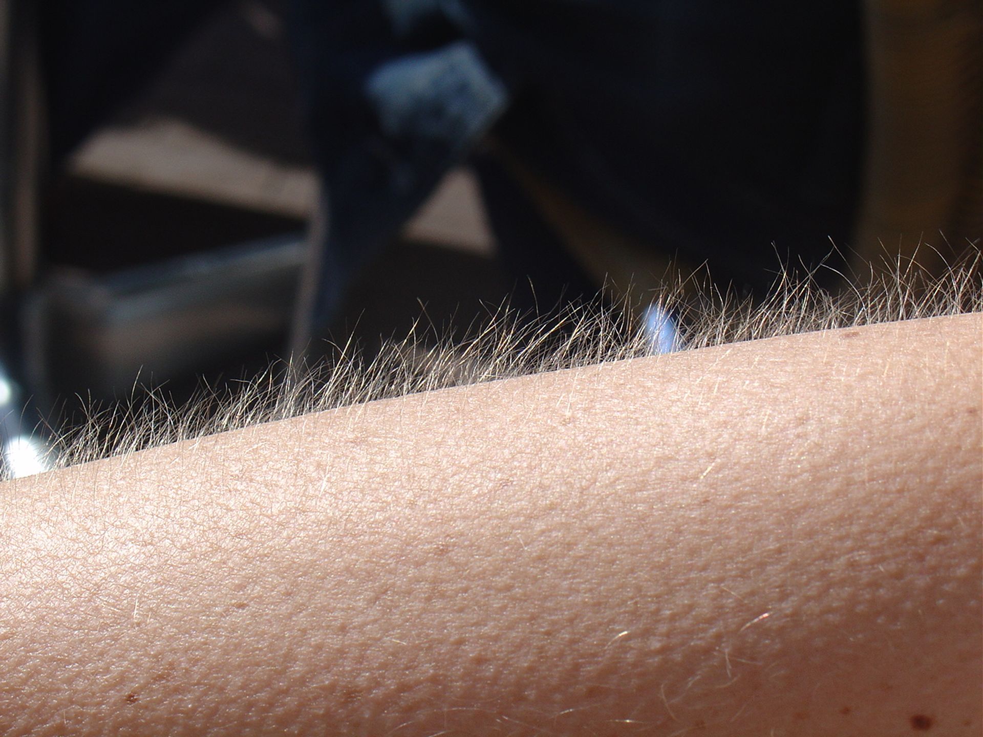 A bare forearm covered in goose bumps, with fine hairs standing straight up