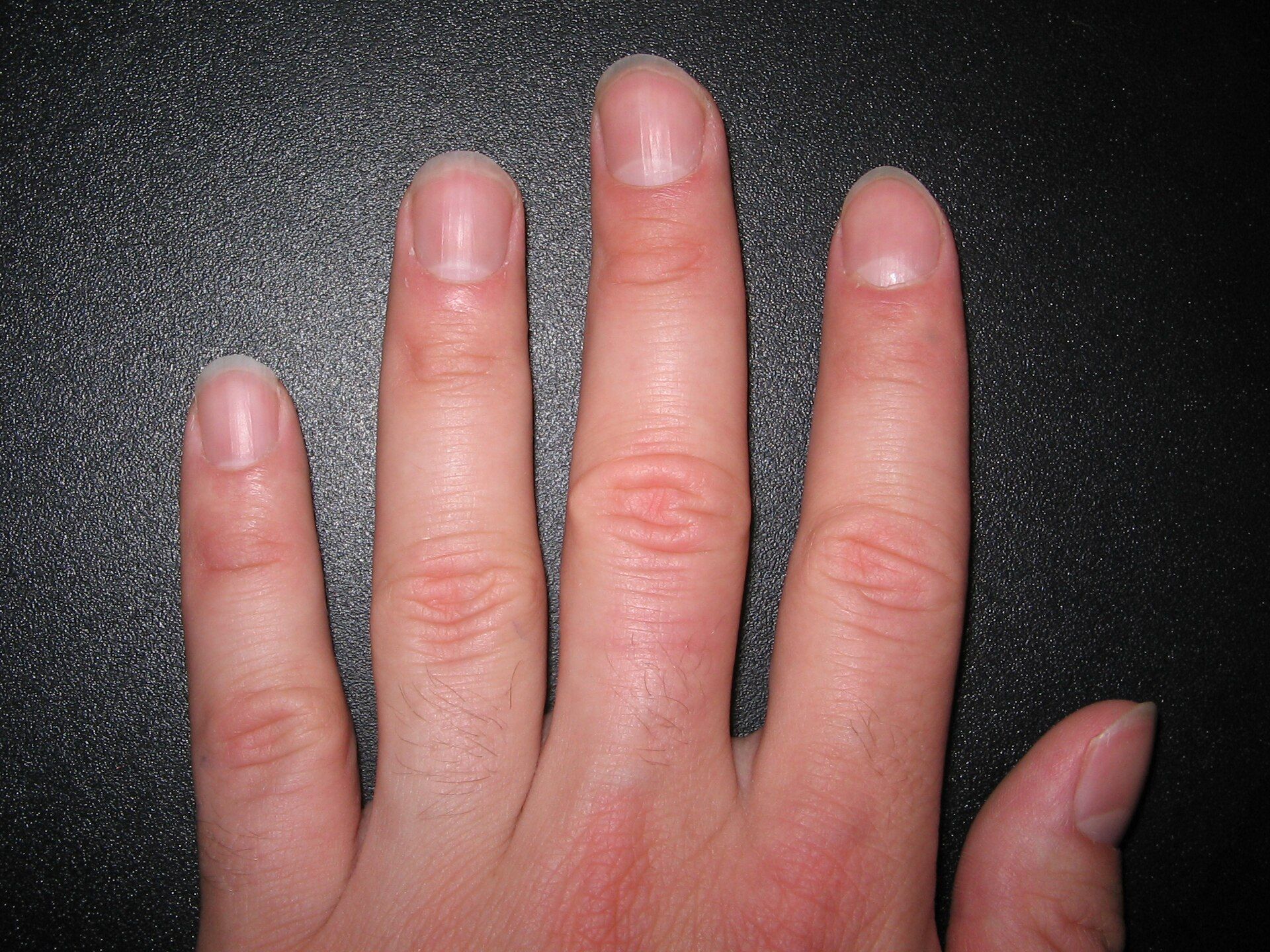 The back of a hand on a dark table, showing four fingers and a thumb with short, clean fingernails