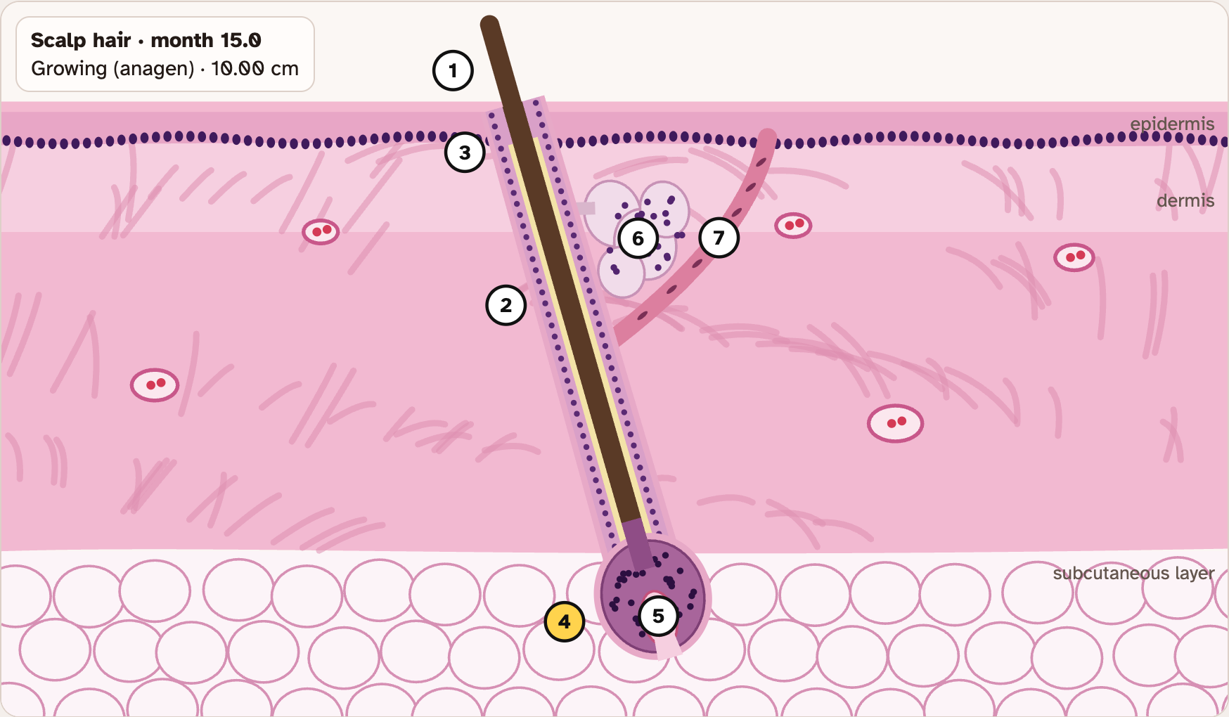 The lab drawing of a hair follicle in the skin, with seven numbered pins on its parts