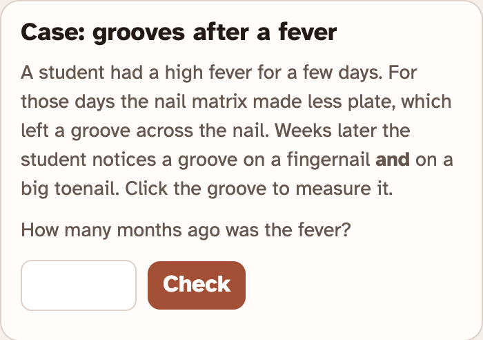 The Case: grooves after a fever card in the lab, with the story of a student who had a fever, a box to type the months and a Check button