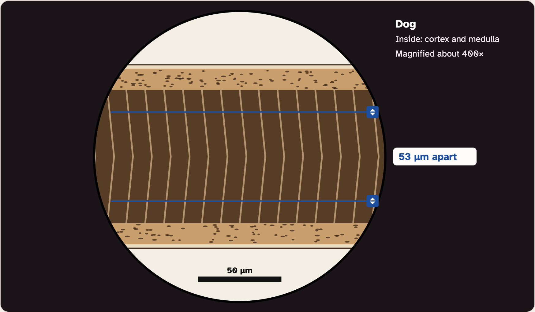 The lab microscope view of a hair with a wide dark core, with two blue measuring lines across it and a label that says how far apart they are