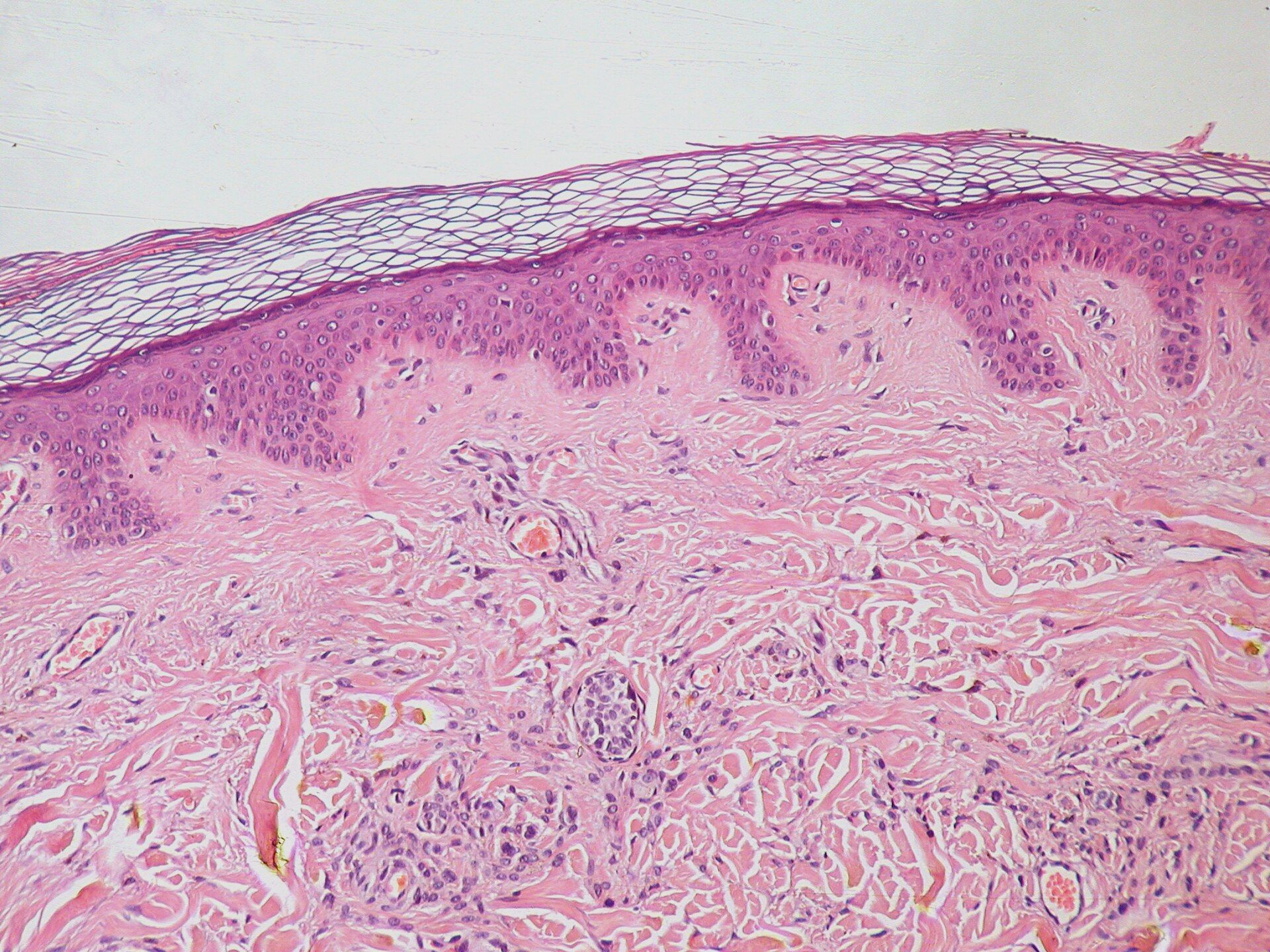 A slice of real skin under a microscope, stained pink and purple: a dark purple band of epidermis on top and pink dermis below