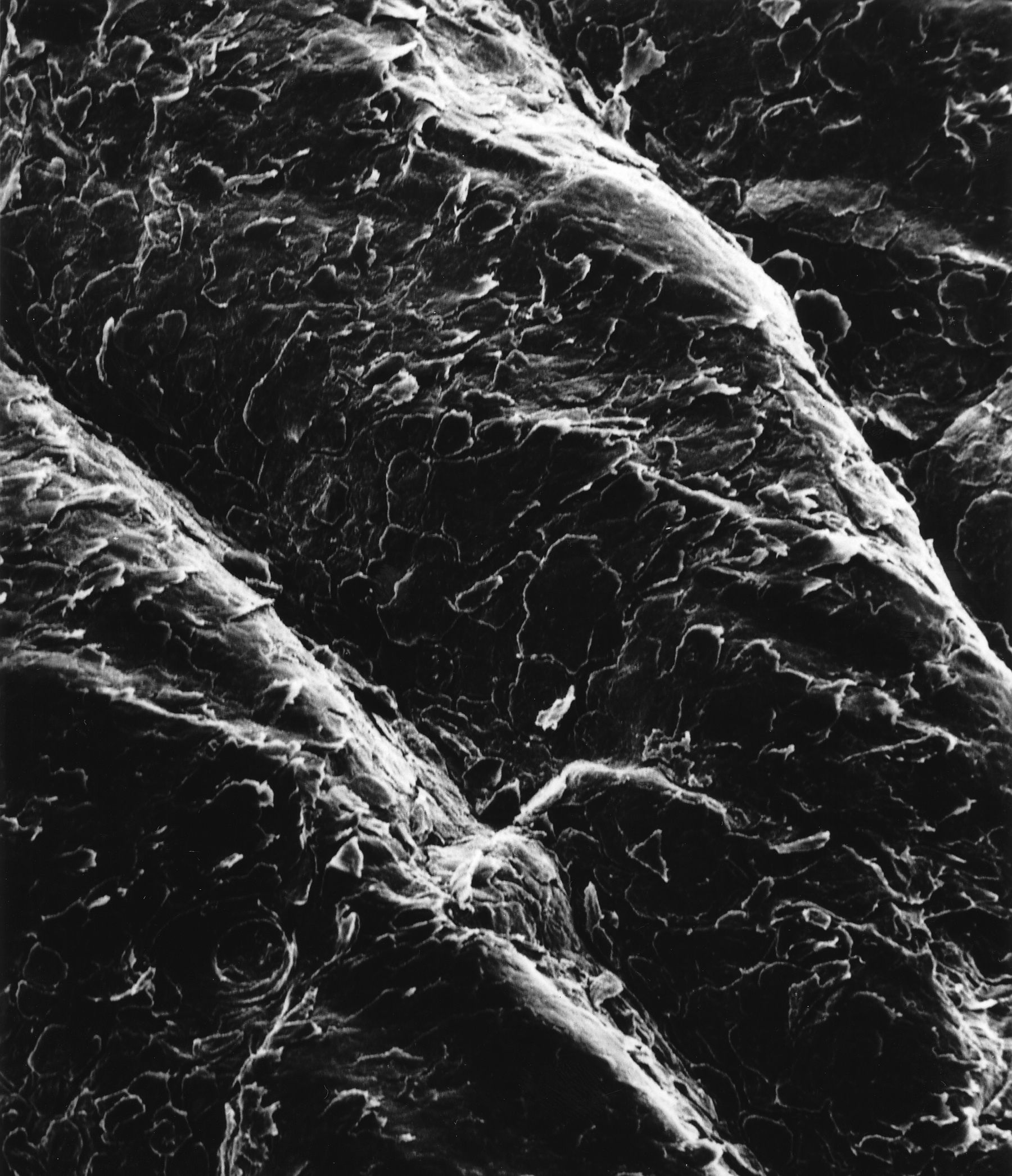 The surface of human skin seen with an electron microscope: flat, flaky plates with raised ridges
