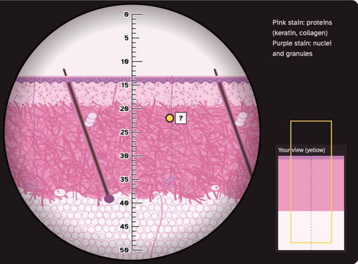 The view down the lab microscope: a round view of pink and purple skin with a scale down the middle and a yellow marker with a question mark