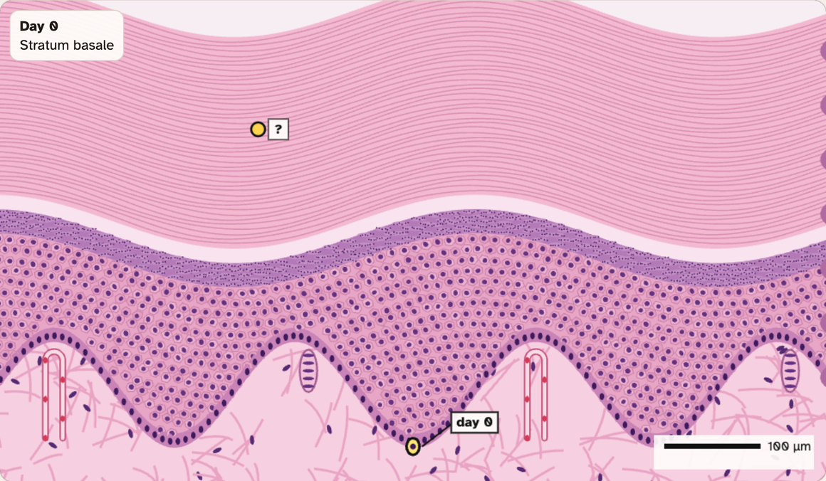 The thick skin epidermis in the lab, drawn as bands of pink and purple cells, with a yellow marker and a question mark on one band