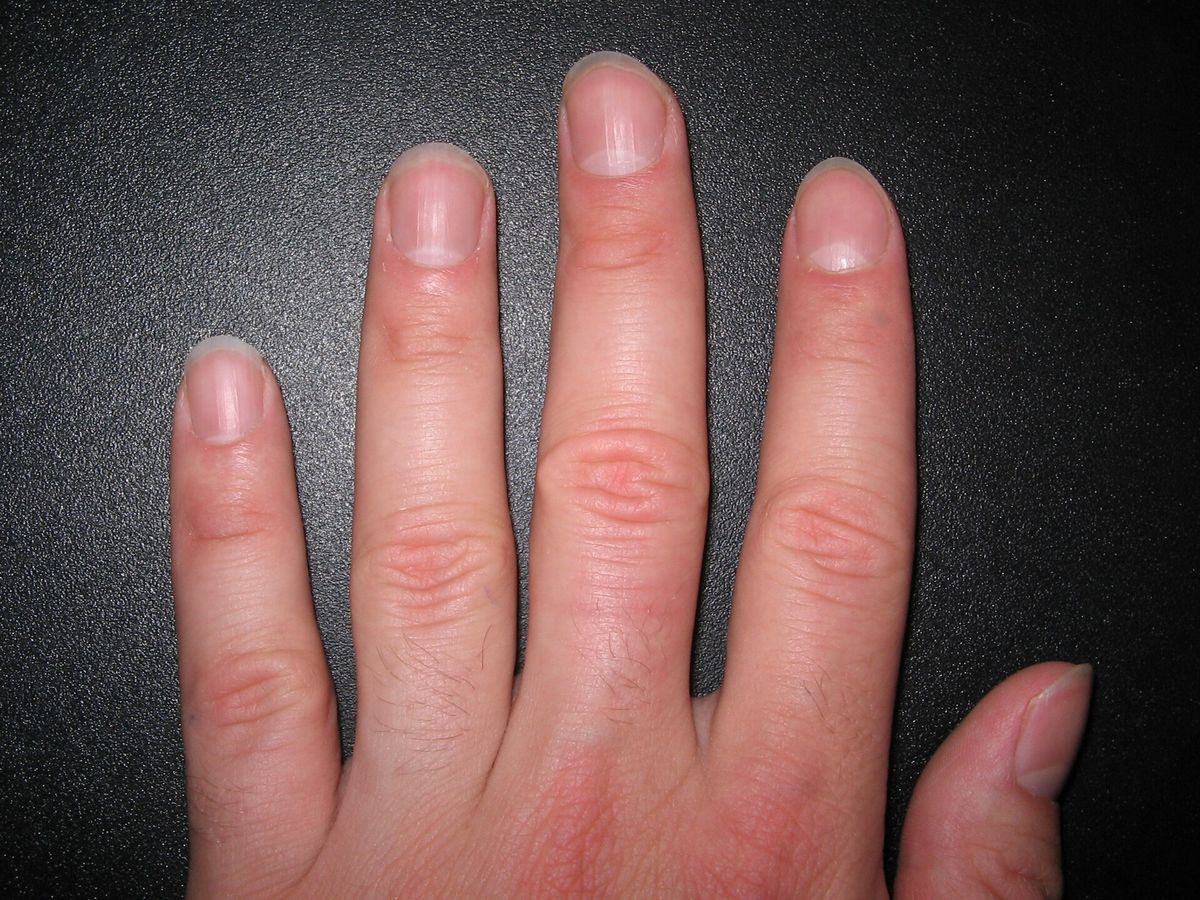 The back of a hand with four short, clean fingernails
