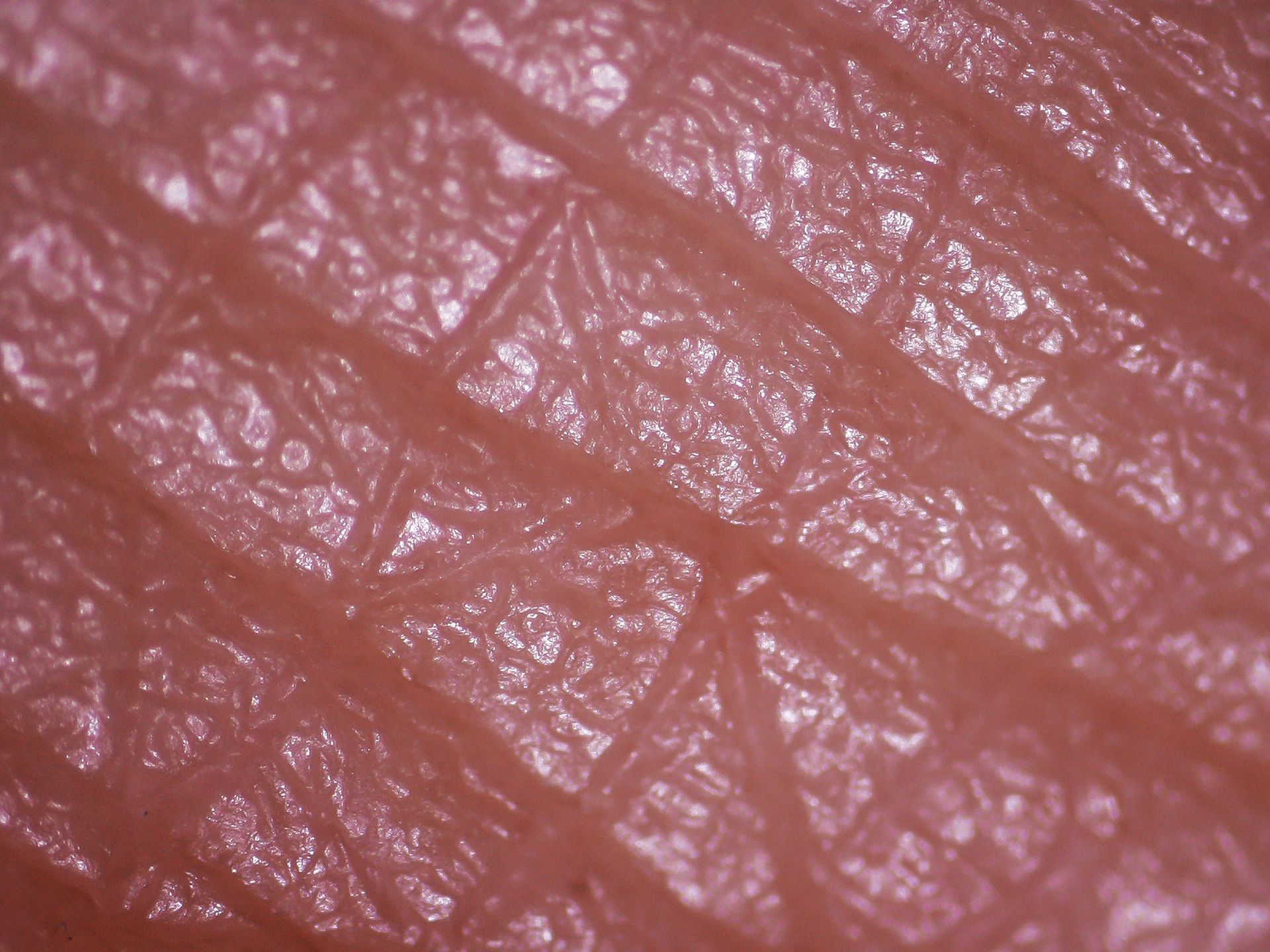 The skin of a hand seen through a microscope: pink skin crossed by fine lines that cut it into small shiny patches